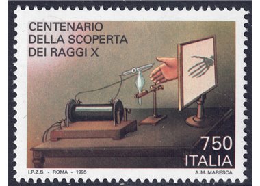 ITALY 1995 X-rays MNH**